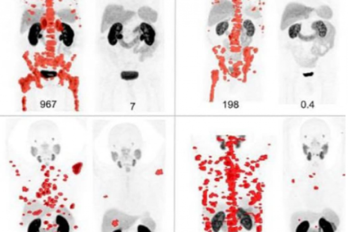 Uzbek scientists develop a new drug effective in treating 99% of cancer