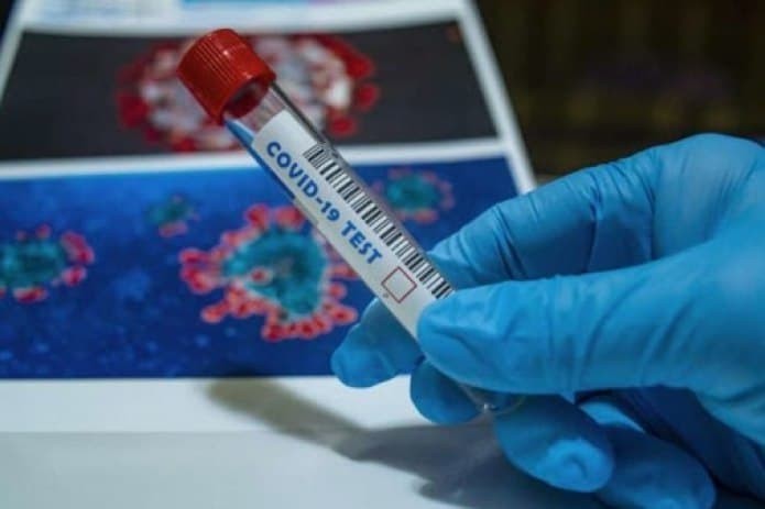За день в Узбекистане коронавирус подтвердился еще у 340 жителей