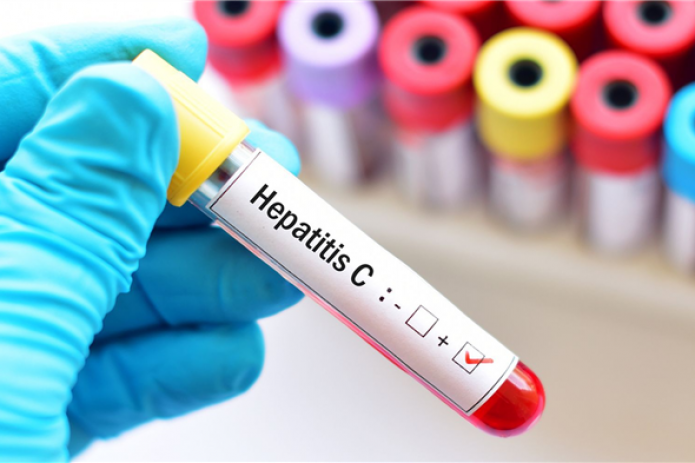 Узбекистанцы смогут сдать бесплатный тест на вирусные гепатиты