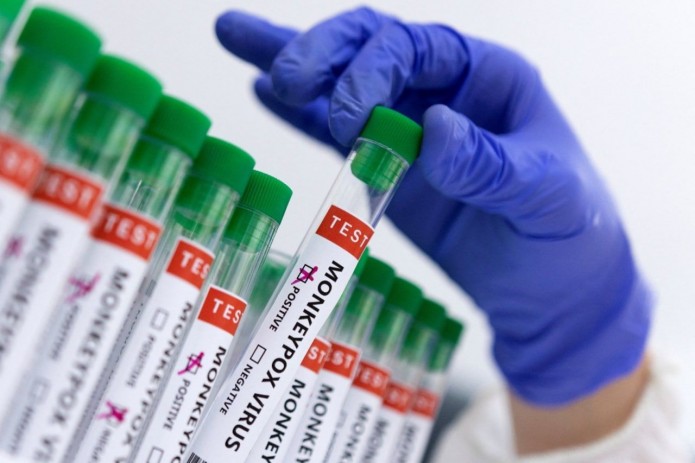 Maymun chechagi epidemiyasi qachon tugaydi?