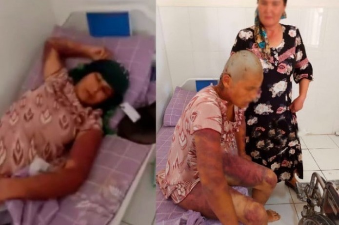 Qashqadaryoda ayolni eri va yaqinlari kaltaklab, sochini kesib tashladi