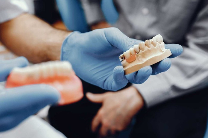 Endi o‘z tishingizdek his qiladigan implantlar yaratiladi