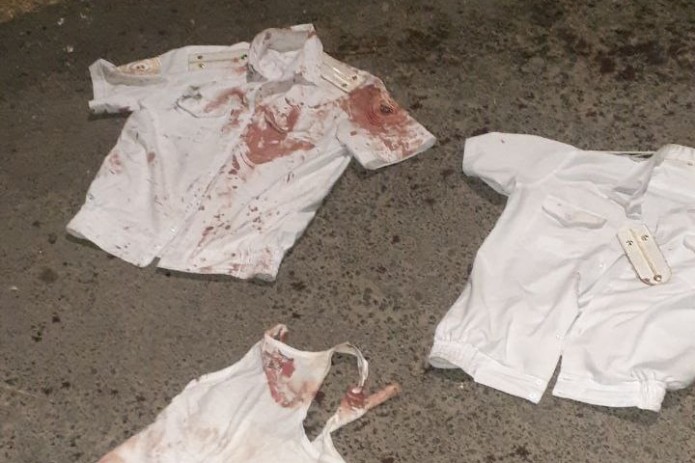 Toshkentda mast fuqaro 2 nafar IIB xodimiga pichoq bilan tahdid qilib, quvladi