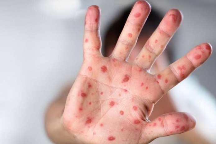 Ichkarida jinsiy aloqa