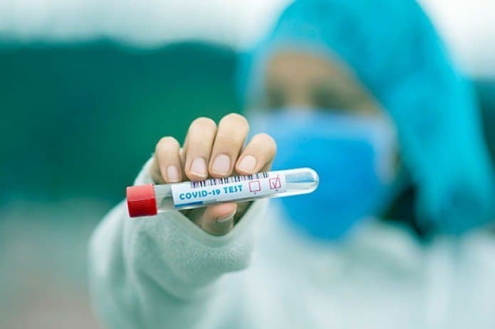 Общее число случаев заражения коронавирусом в стране превысило 180 тыс.