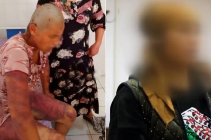 Qashqadaryoda 38 yoshli ayolni kaltaklagan 4 kishidan 2 tasi qamaldi, boshqa 2 tasi ozodlikdan cheklash bilan jazolandi