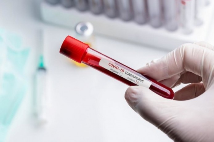 В Узбекистане выявили 29 новых случаев заражения коронавирусом