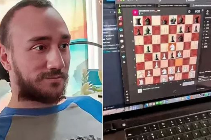 Neuralink chipi o‘rnatilgan erkak bir haftada fikr kuchi orqali videoo‘yin o‘ynashni o‘rganib oldi