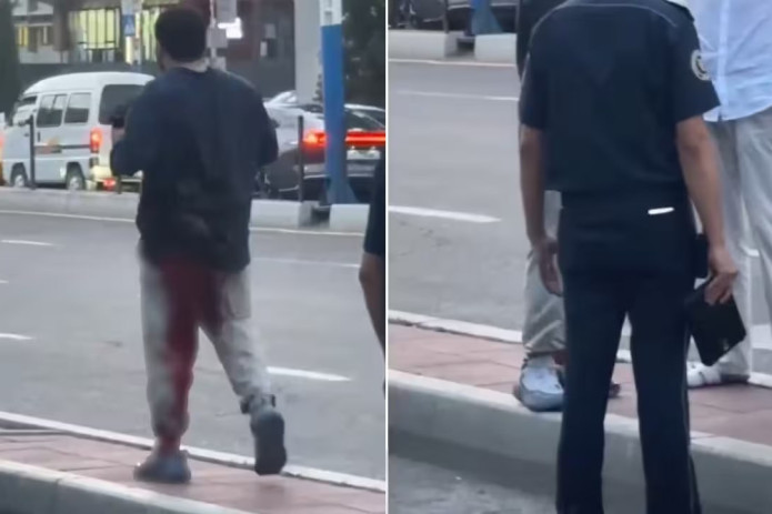 Toshkentda 22 yoshli yigit ko‘chada 19 yoshli tanishini pichoqlab, jarohat yetkazdi