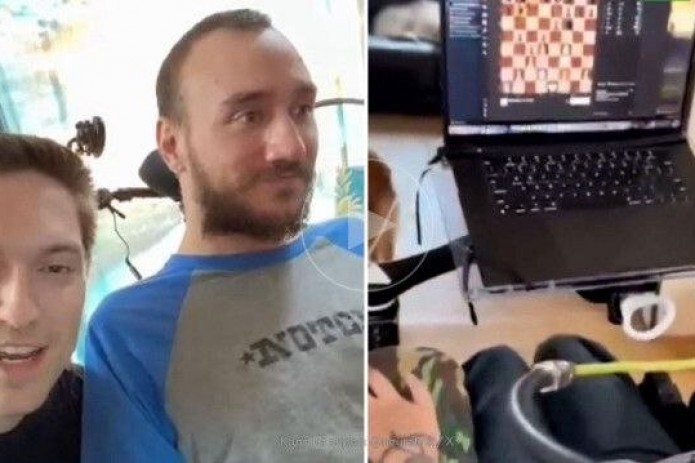 Miyasiga chip o‘rnatilgan odam shaxmat o‘ynadi
