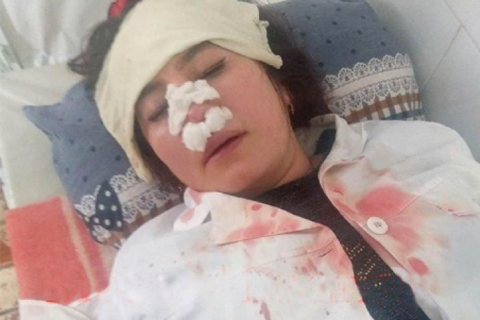 Две узбекистанки избили врача до сотрясения мозга