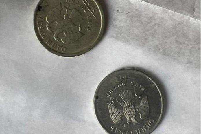 Buxoroda 2 yashar bolaning tomog‘idan ikkita tanga topildi