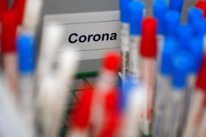 Пандемия коронавируса COVID-19. Самое актуальное на 1 мая
