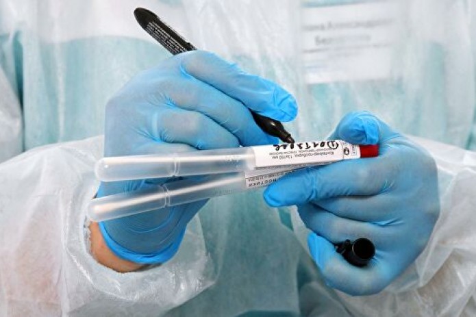 Число инфицированных коронавирусом в Узбекистане выросло до 546
