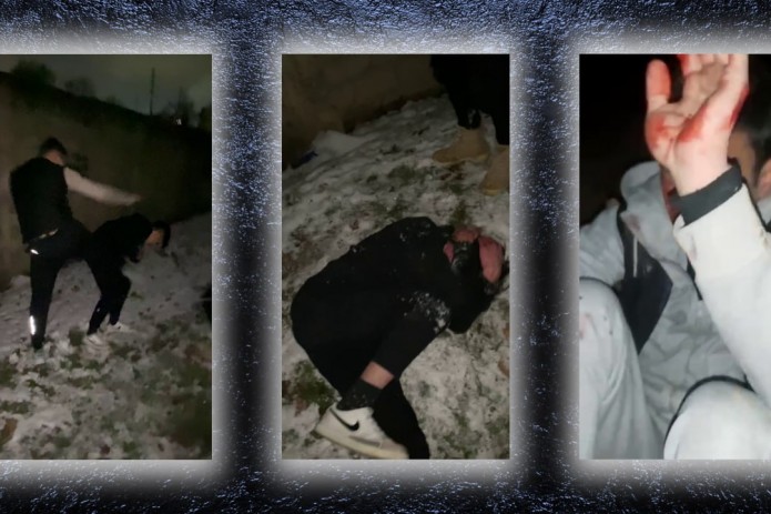 Toshkent viloyatida yigitlarni urib, badani va yuziga “zelyonka” sepgan mushtumzo’rlar ushlandi