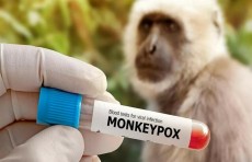 Россия направила в Узбекистан тесты для выявления оспы обезьян